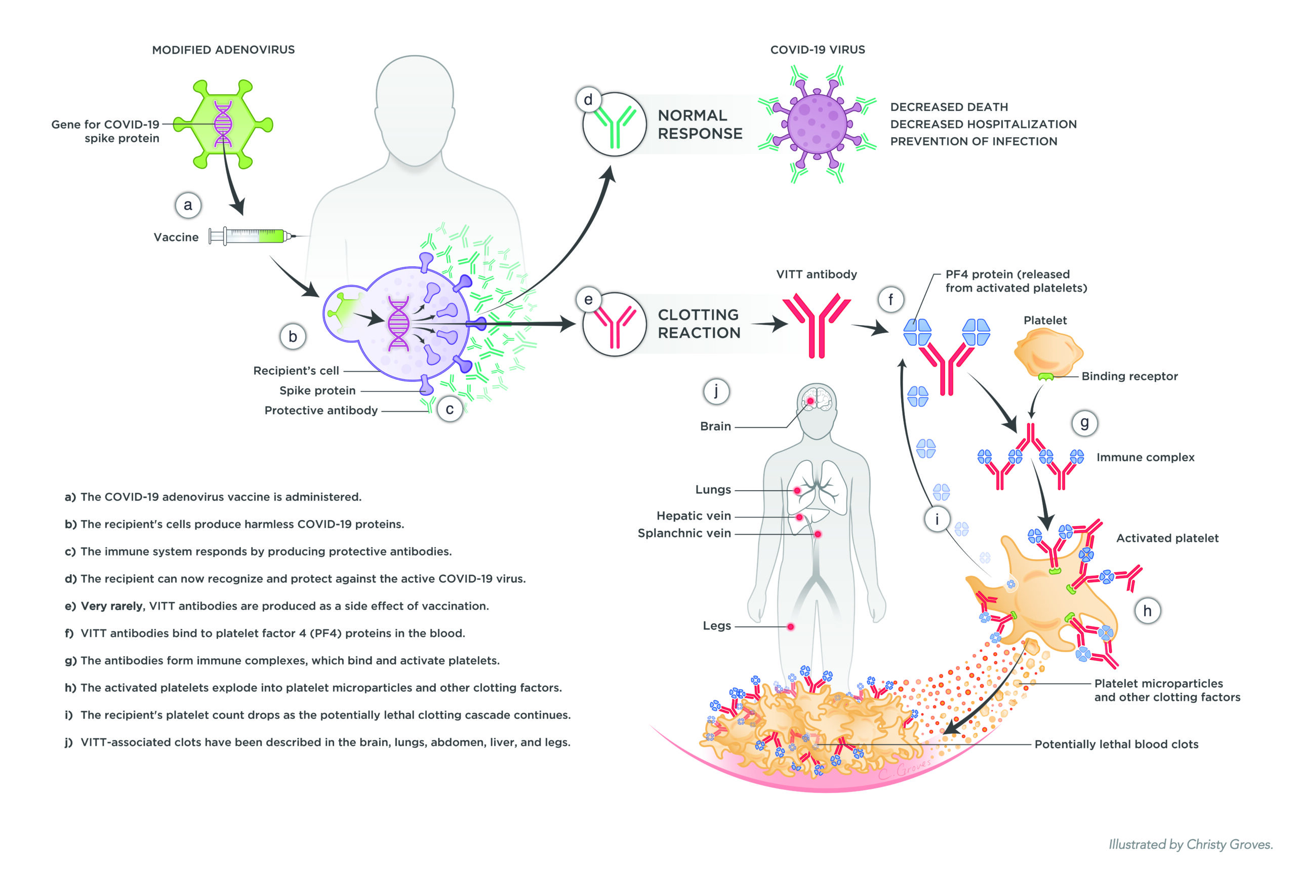 A Visualization of Vaccine-Induced Immune Thrombotic Thrombocytopenia (VITT)